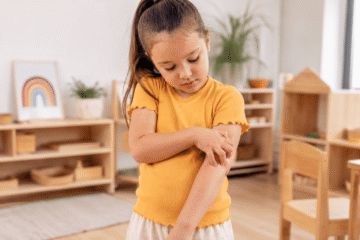Mädchen kratzt sich am Arm.